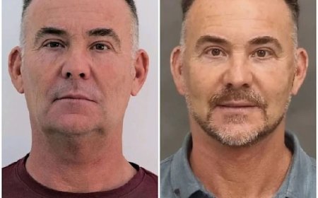 Frame Glow using Profhilo Treatments in Dubai