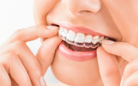 Invisalign Braces Dubai: Straighten Teeth Invisibly and Comfortably