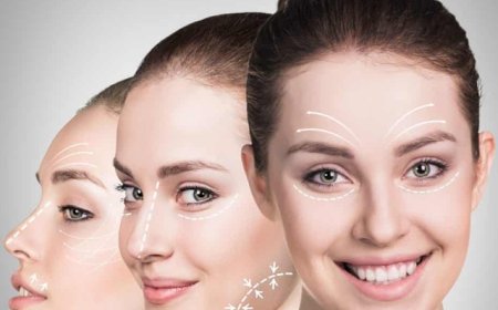 Best Doctors in Dubai for Profhilo: Frequently Asked Questions