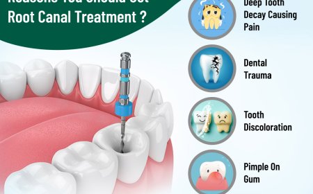 Painless Root Canal Treatment in Hoodi Bangalore: Modern Care for Tooth Pain Relief