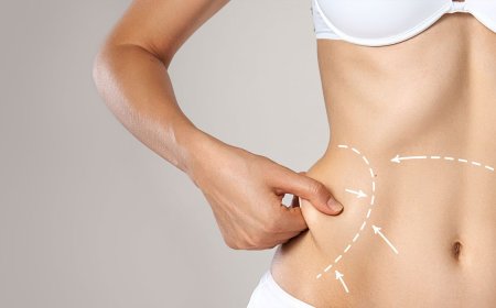 Liposuction in Dubai: A Comprehensive Guide to Costs, Procedures, and Results