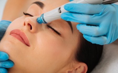 Discover the Best Skin Clinic in Richmond Transform Your Skin with Miss Morpho